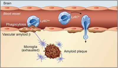 Innate Immune Cells: Monocytes, Monocyte-Derived Macrophages and Microglia as Therapeutic Targets for Alzheimer’s Disease and Multiple Sclerosis